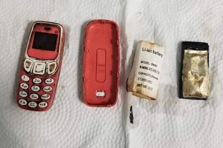 MÃ²bil tret d'un estÃ³mac