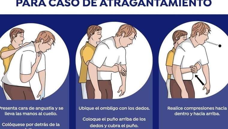 Tres pasos de Maniobra d'Heimlich