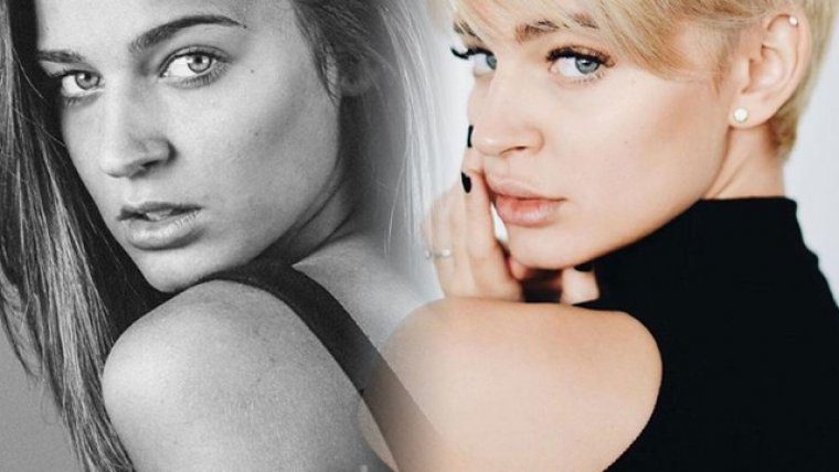 Laura Escanes, antes y despuÃ©s de operarse el labio superior