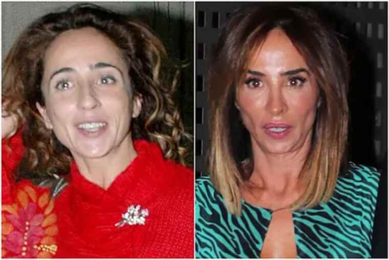 Collage de MarÃa Patiño abans i després de les seves múltiples operacions